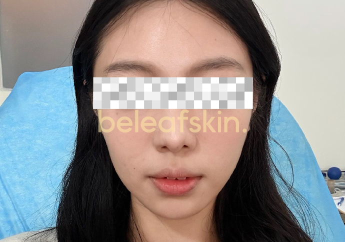 Before
